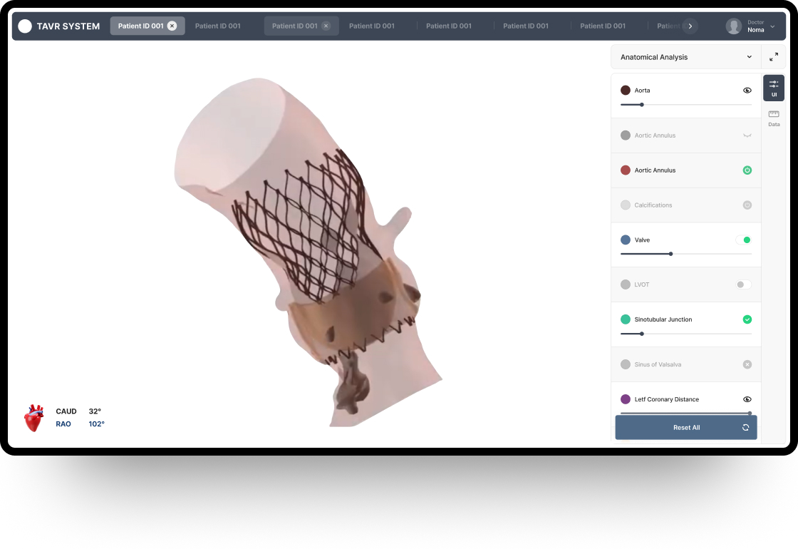 NXT UIUX 포트폴리오 | 웹사이트 반응형 제작 메인시안